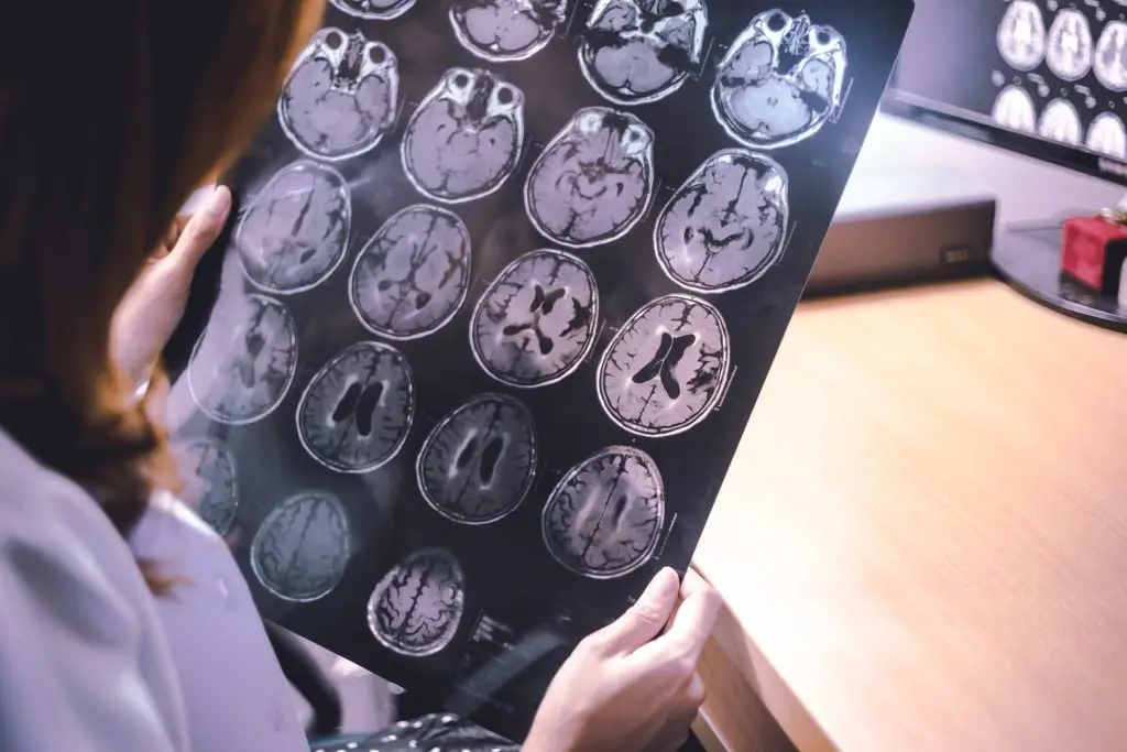 neuroscience psychotherapy client tip work with client´s brain jules shore